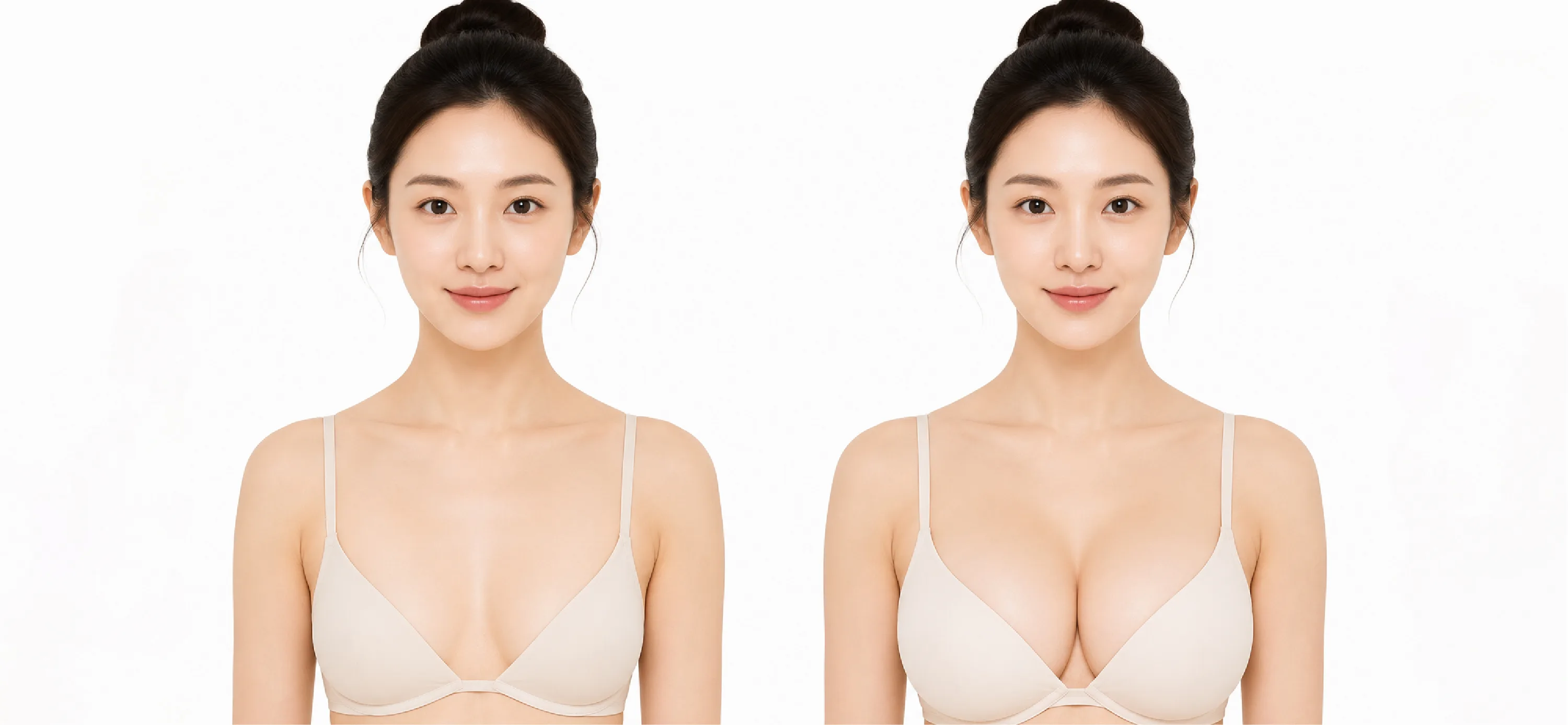 整形外科 術前術後