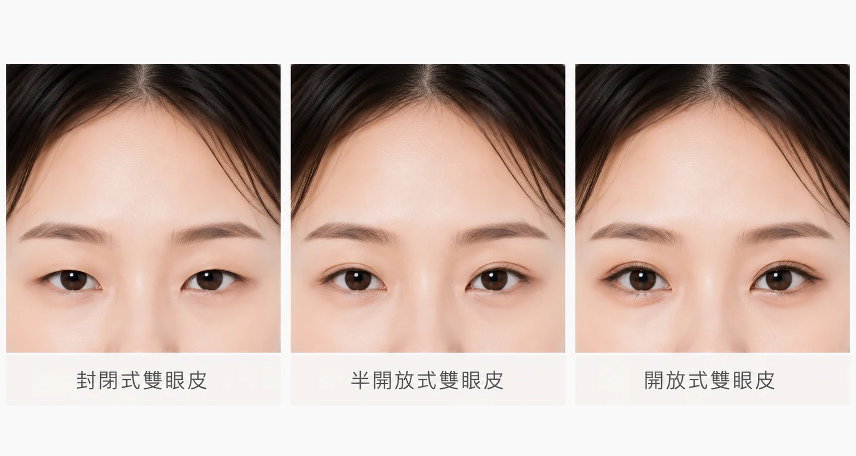 透析雙眼皮風格